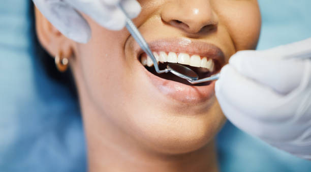 Best Emergency Root Canal Treatment in Minot, ND